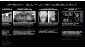 Что использовать для планирования в Кант